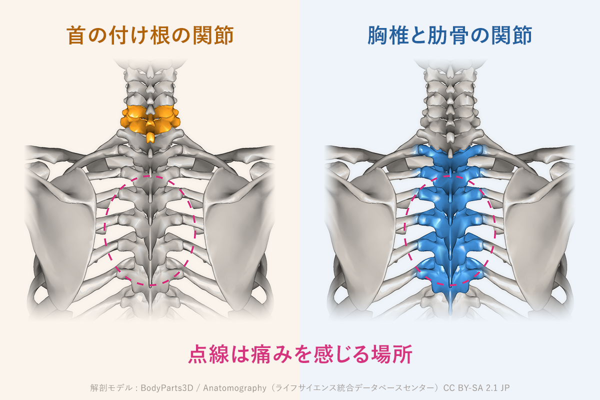 肩甲骨の間の痛みが続いている方。痛む場所に原因はある？