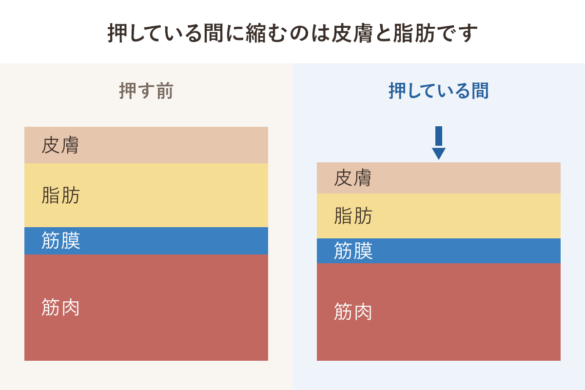 筋膜リリースで軽くなる方。変わっているのは筋膜？